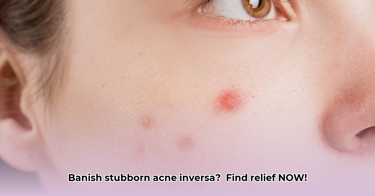 acne-inversa